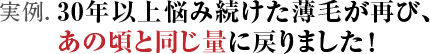 実例：30年以上悩み続けた薄毛が再び、あの頃と同じ量に戻りました