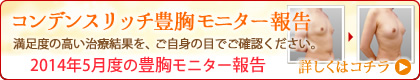 豊胸モニター報告(コンデンスリッチ豊胸)