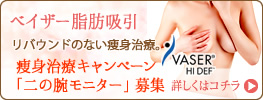 ベイザー脂肪吸引モニターキャンペーン