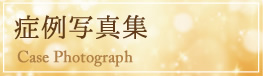 痩身症例写真